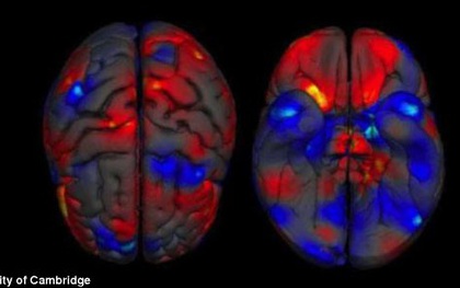 Bạn có tin: Bộ não của nam giới thực sự lớn hơn nữ giới?