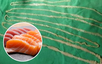 Tìm thấy sán dài 2m6 làm tổ trong ruột bé gái nghiện ăn đồ sống Nhật Bản