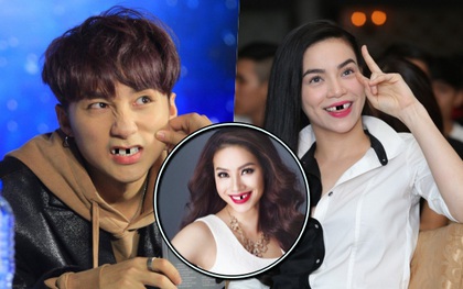 Trai xinh, gái đẹp showbiz Việt sẽ ra sao nếu một ngày bất ngờ… sún răng?
