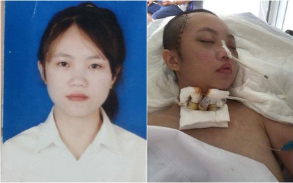 Biến cố cuộc đời của nữ sinh bị tai nạn giao thông trên đường đi học