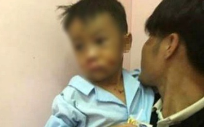 Hà Tĩnh: Vật thể lạ nghi kíp mìn phát nổ, bé trai 8 tuổi dập nát bàn tay