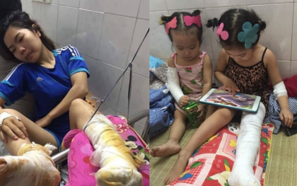 Đâm vào đống tro than đang âm ỉ cháy, 3 cô cháu bị bỏng nặng