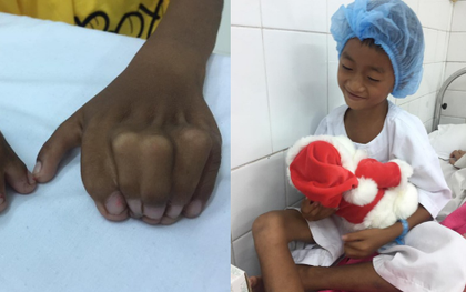 Quà giáng sinh đến sớm với cậu bé không thể đến trường vì “đôi bàn tay ếch” kỳ dị