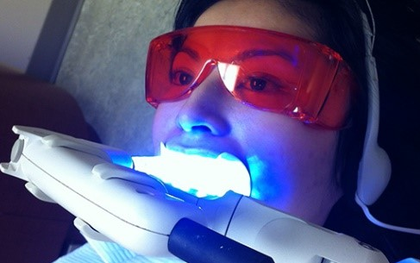 Chuyên gia bật mí ưu nhược điểm các phương pháp tẩy trắng răng phổ biến hiện nay
