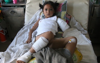 Bé gái 8 tuổi bị cụt tay sau tai nạn ngày mùng 4 Tết: “Ba ơi! Sao tay trái con ngắn hơn tay phải?!”