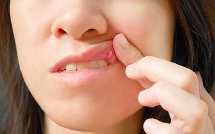 Chỉ nhìn mặt cũng đoán được bạn đang bị thiếu vitamin gì