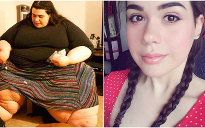 Mập đến mức không di chuyển được, cô nàng quyết giảm 120kg bất chấp bạn trai chỉ thích con gái "béo tốt"