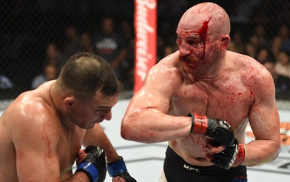 Võ sĩ MMA khoe gương mặt “nát bét” sau trận huyết chiến