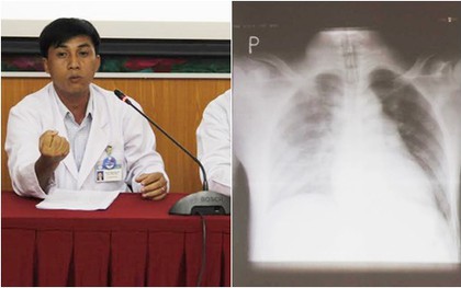 Bị đâm 8 nhát đứt động mạch vú vẫn may mắn thoát khỏi lưỡi hái tử thần
