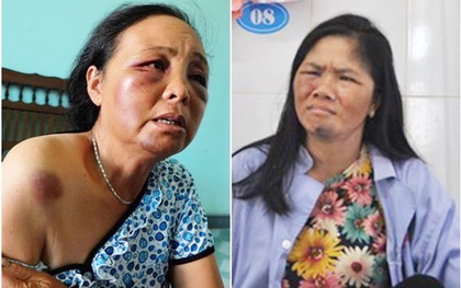 Công an triệu tập nhiều người hành hung 2 người phụ nữ bán tăm vì nghi bắt cóc trẻ em