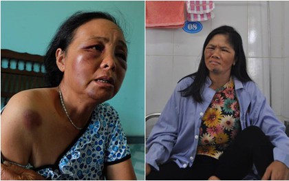 Người thân nhóm người hành hung đến nhà xin lỗi 2 phụ nữ bán tăm bị đánh oan vì nghi bắt cóc trẻ em