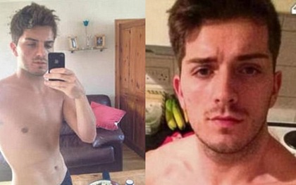 Lợi dụng vẻ ngoài điển trai, gã thợ cắt tóc hẹn hò qua mạng rồi truyền HIV cho 4 bạn tình đồng tính