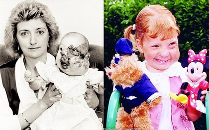 Sinh ra với gương mặt biến dạng và bị người đời xa lánh, phép màu đã khiến cuộc đời cô gái thay đổi sau 25 năm