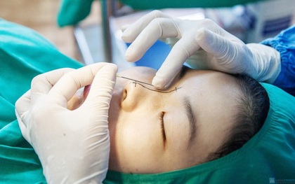 Trước khi quyết định phẫu thuật thẩm mỹ, nhất định phải đọc kỹ những điều này