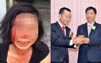 Con trai người phụ nữ bị chồng bạo hành tại Đồng Nai: “Mẹ bị cha dượng đánh suốt 23 năm nay"