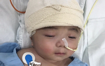 Một ngày sau cuộc tiểu phẫu, em bé não úng thủy Phạm Đức Lộc đã biết mở mắt, cử động tay chân