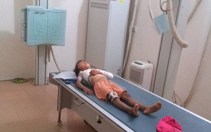 Bé lớp 1 bị cửa sắt đè gãy xương, hiệu trưởng bảo không có trách nhiệm