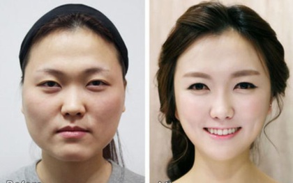 Kimchi woman: Cách dân Hàn Quốc gọi các cô nàng nghiện thẩm mỹ, mê hàng hiệu và "đào mỏ" đàn ông giàu có