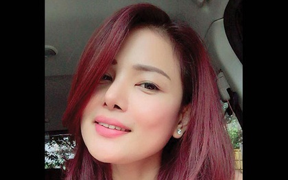 Phẫu thuật thẩm mỹ, nữ doanh nhân xinh đẹp chết thảm