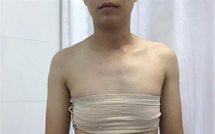 Sắp tiến hành ca phẫu thuật chuyển giới đầu tiên tại VN