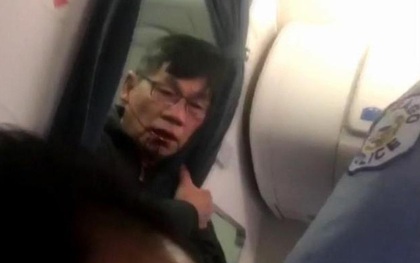 Bác sĩ gốc Việt bắt đầu đưa United Airlines ra tòa