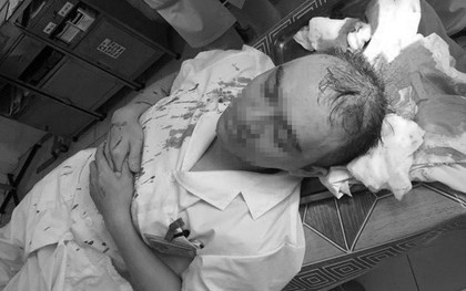 HN: Bác sĩ bị đánh bất tỉnh, theo dõi chấn thương sọ não