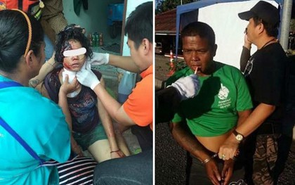 Thái Lan: bé gái 13 tuổi bị cha rạch cổ vì dành quá nhiều thời gian cho mạng xã hội