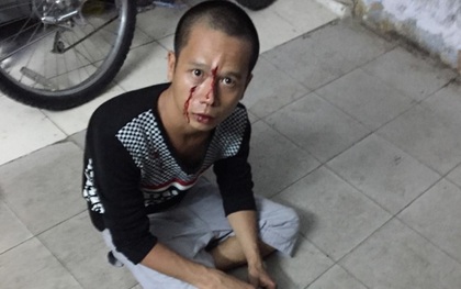 (HY HỮU) Tên cướp bị CSGT bắt vì... kẹt xe!