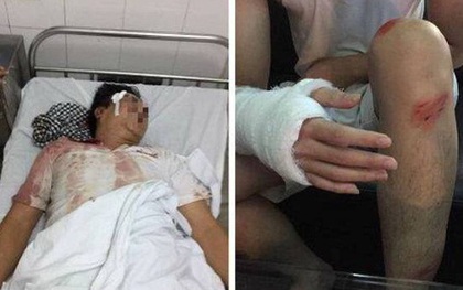 Côn đồ hành hung dã man lúc nửa đêm, 4 người ở Hà Nội nhập viện