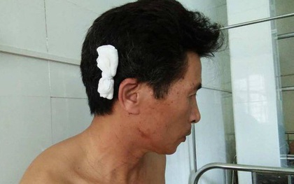 Hà Nội: Cả gia đình bất ngờ bị nam thanh niên lạ mặt lao vào đánh trọng thương