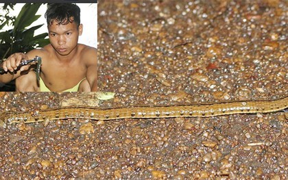 Hãi hùng vì bị đỉa bu đen... tấn công