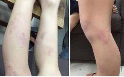 Chủ tịch HN: Làm rõ vụ 11 học sinh lớp 2 bị giáo viên bạo hành