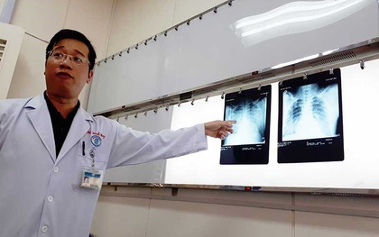 Thực hư virus lạ gây chết người