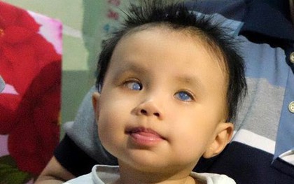 Hàng loạt bé mổ đục thủy tinh thể xong… không nhìn thấy gì