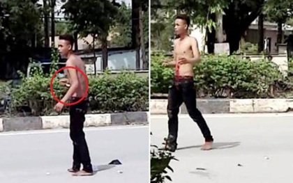 Nam thanh niên nghi “ngáo đá” tự đâm xổ ruột giữa đường