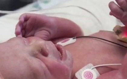 Mỹ chào đón em bé đầu tiên sinh ra từ bà mẹ được ghép tử cung