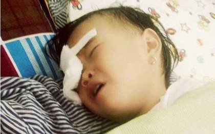 Nghệ An: Bé gái 2 tuổi bị gà chọi đá, nguy cơ hỏng mắt phải