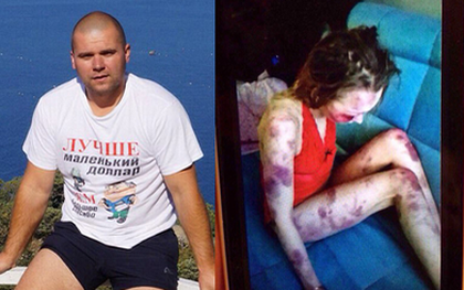 Người chồng "quái vật" đánh vợ rồi hạ nhục bằng cách khoe “thành tích” với bạn bè trước khi vợ qua đời