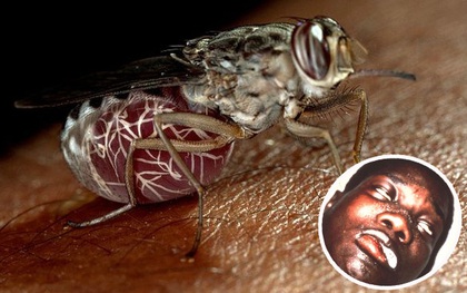 Phát hiện ra cơ chế hút, truyền bệnh chết người - nguy hiểm hơn cả sốt xuất huyết của loài ruồi xê xê