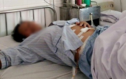 Phẫu thuật lấy ra hàng trăm viên sỏi nằm trong túi mật bệnh nhân ở Nghệ An
