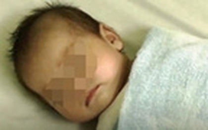 Bé trai 6 tháng tuổi tím tái trong chiếc chòi lá bỏ hoang