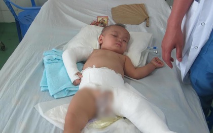Cứu sống bé trai 15 tháng tuổi rơi từ tầng 5 chung cư xuống đất