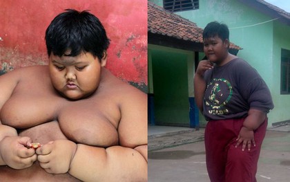 Giảm cân ngoạn mục, cậu bé nặng nhất thế giới năm nào giờ đã có cơ thể "nhẹ nhõm" hơn rất nhiều