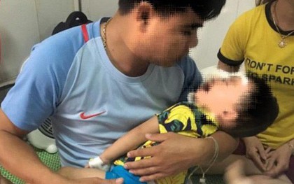 Bé trai 2 tuổi bị chó becgie nhà nuôi cắn đa chấn thương ở mặt