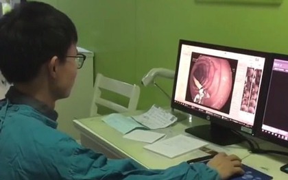 Đau bụng cả tháng, người phụ nữ đi khám phát hiện thấy một cây tăm nhọn dài 7cm không hiểu từ đâu chui vào bụng
