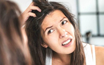 Cẩn thận kẻo đầu đầy gàu chỉ vì chính những việc mà bạn làm hàng ngày