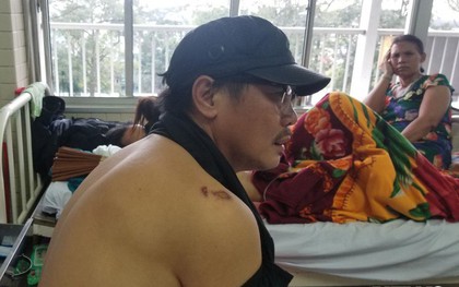 Đạo diễn tố Công an Cần Thơ bắt, đánh đập vô cớ: Trường Sân khấu Điện ảnh TP.HCM thông tin bất ngờ