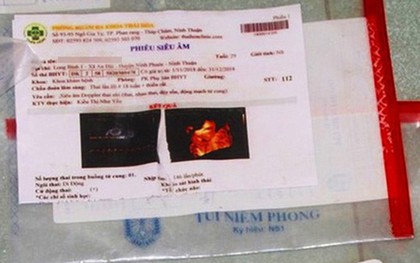 Thai phụ 29 tuổi ở Ninh Thuận tử vong khi đi phá thai chui: Bộ Y tế vào cuộc