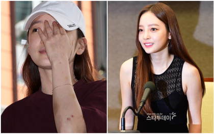 Vừa khóc vừa tuyên bố hoạt động trở lại ngay sau scandal, Goo Hara làm netizen Hàn tranh cãi nhiệt liệt