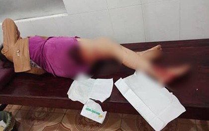 Công an vào cuộc xác minh vụ cán bộ quản lý thị trường hành hung chị dâu vì mâu thuẫn tiền bạc